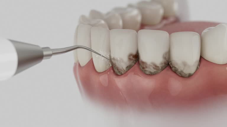 Reliable Dental Crowns And Bridges contractor in Louisa County County, VA by Dentist Open Now